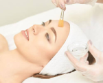 Chemical Peel